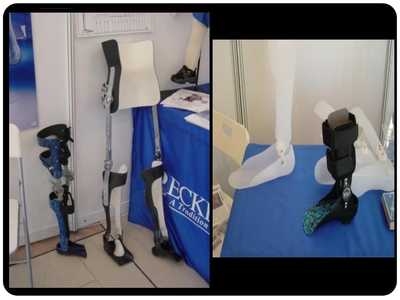 假肢与矫形器 功能、技术与应用概述