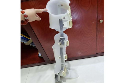 假肢与矫形器的使用周期与更换指南 科学维护，保障生活品质